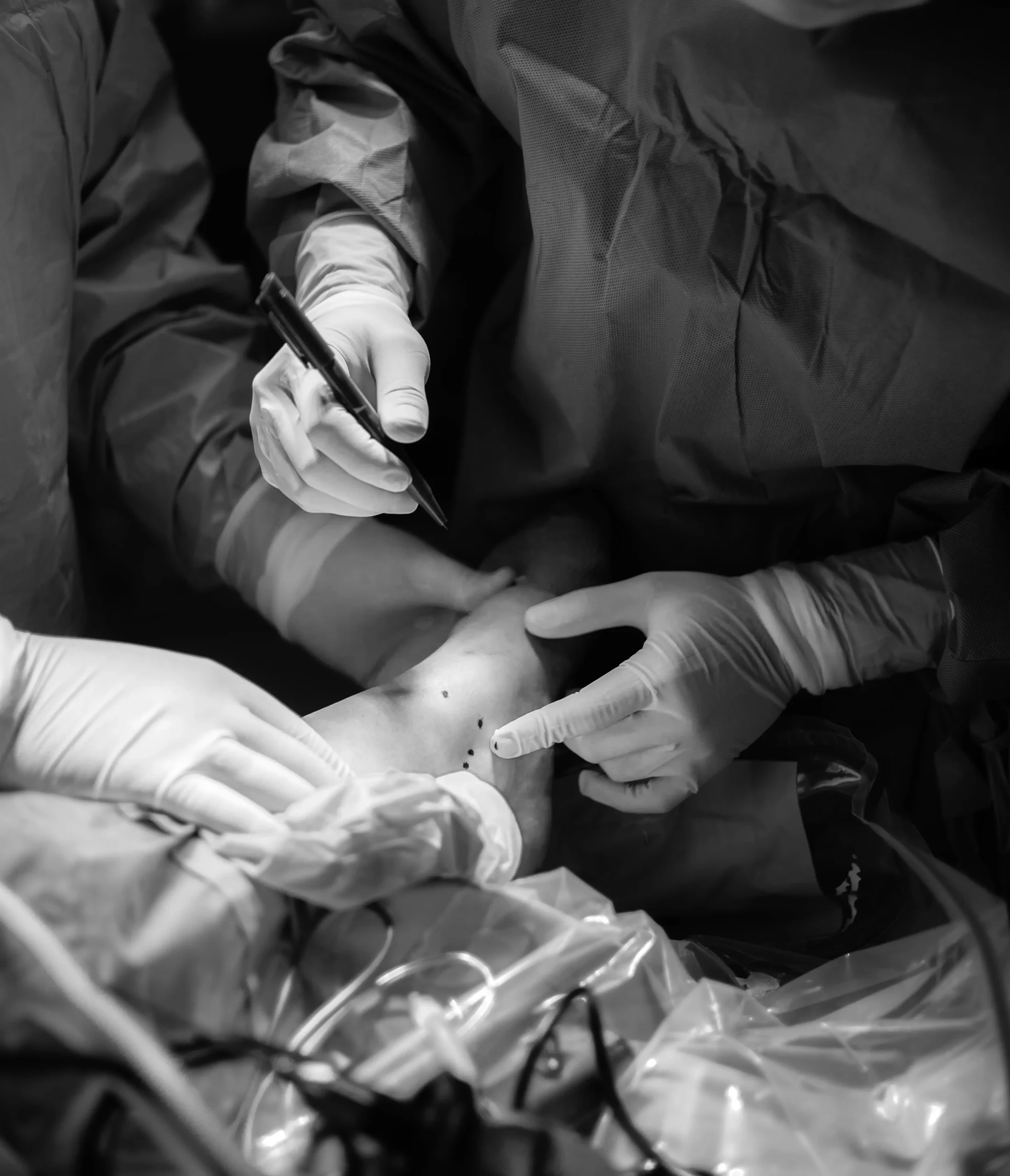 Artroscopia de tobillo izquierdo Cirugía de Traumatología