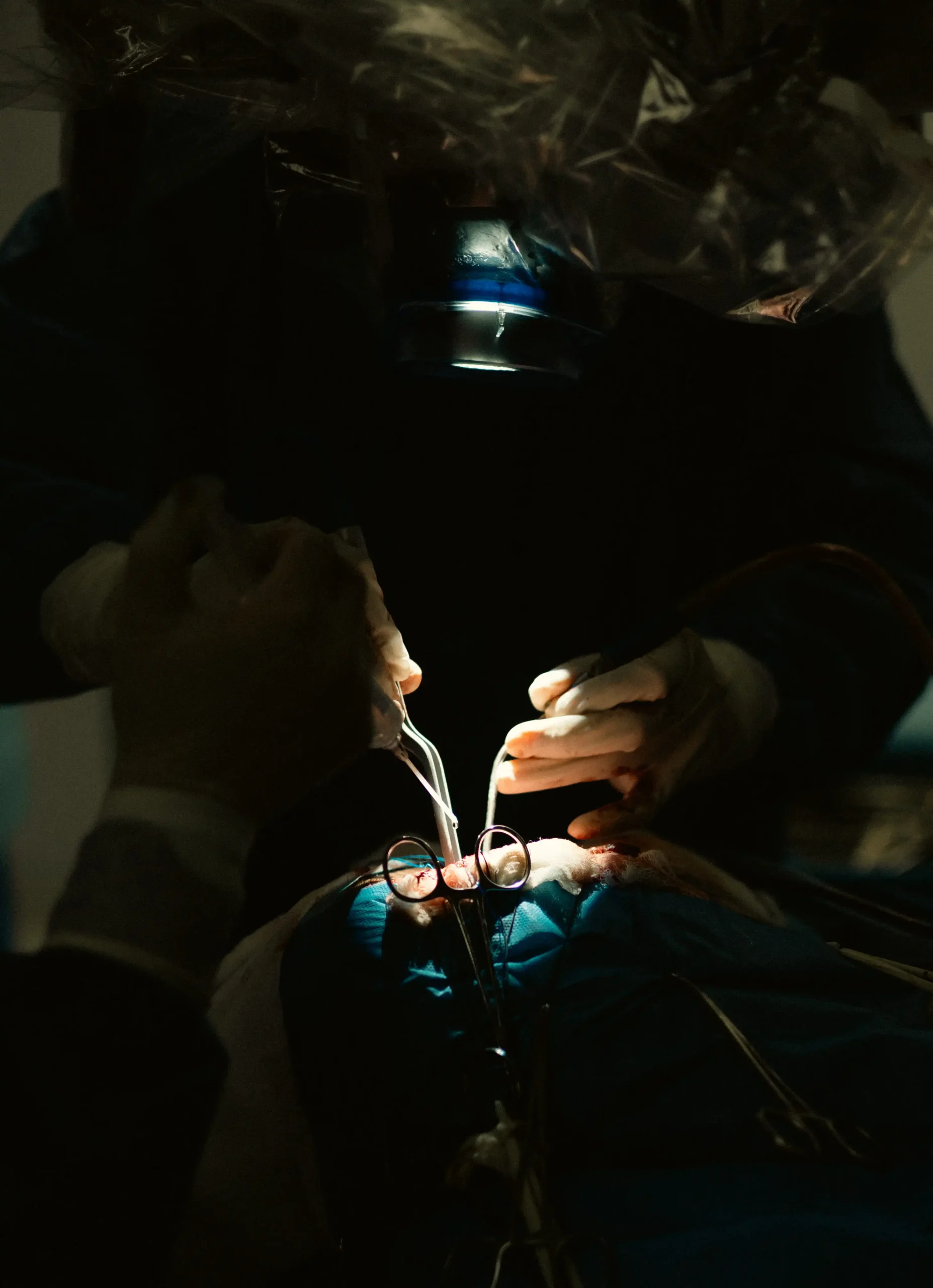 Resección de tumor en ala de esfenoides izquierdo probable meningioma.