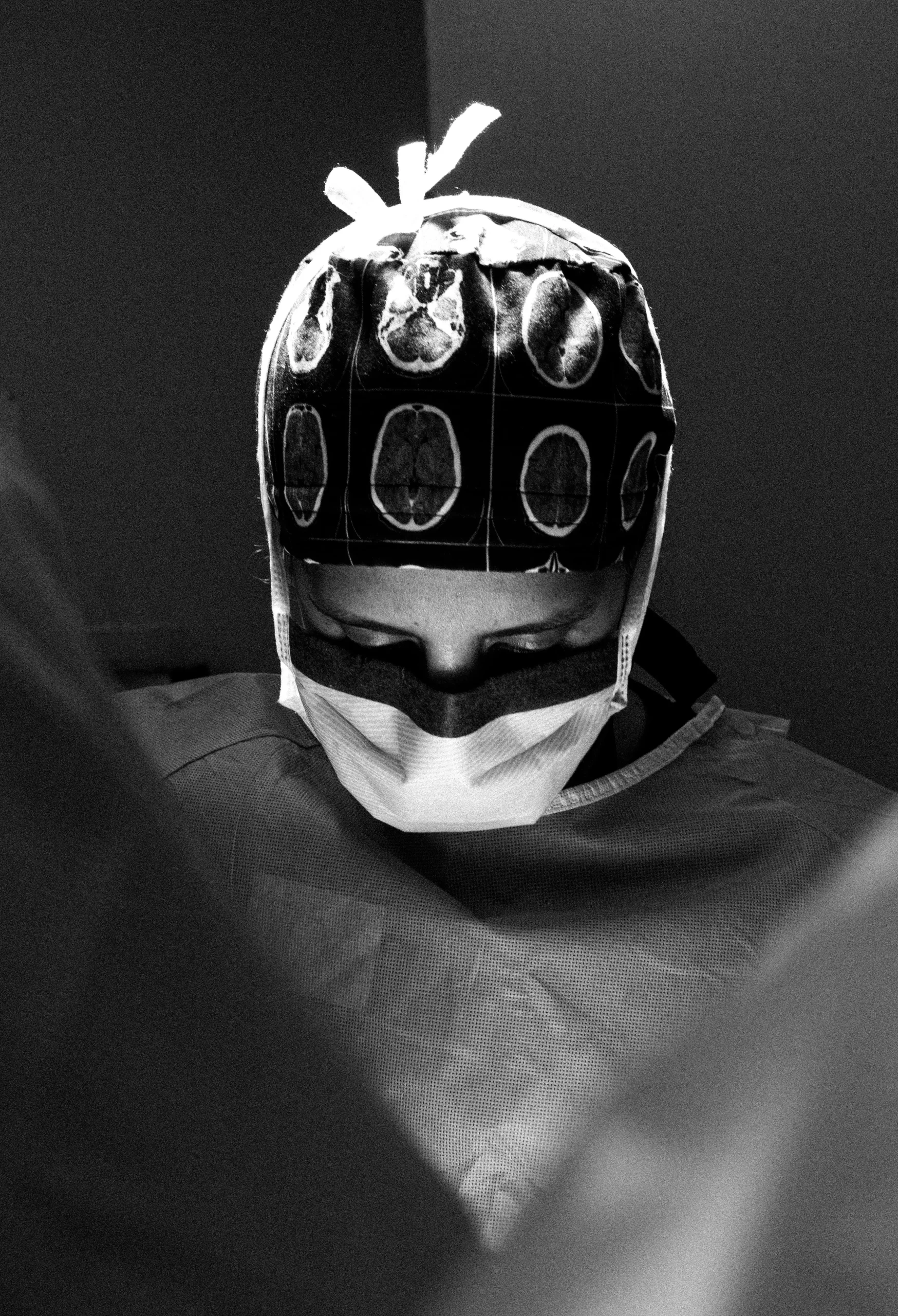 Descompresión cervical posterior
