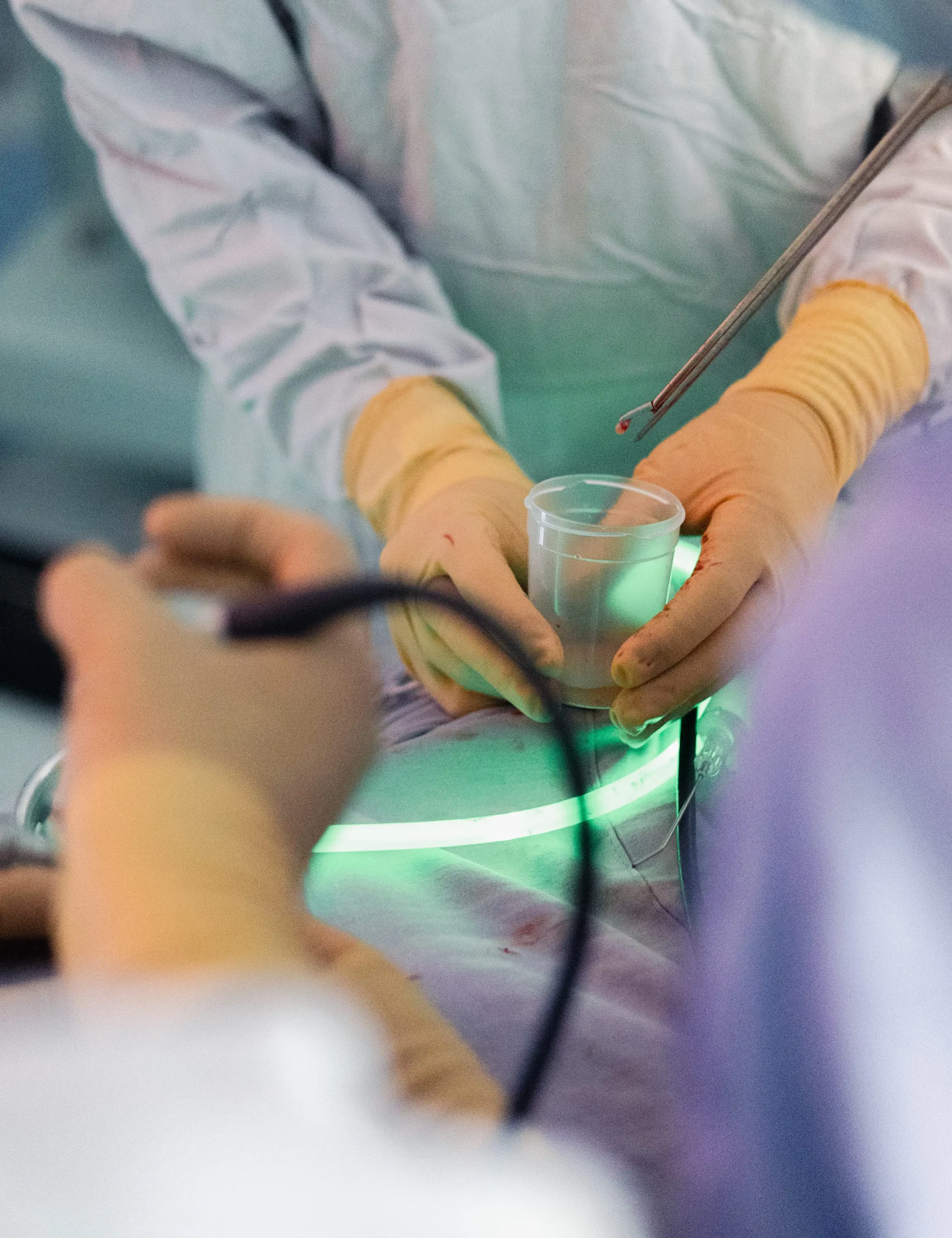 Resección transesfenoidal de tumor hipofisario Cirugía de Traumatología y Ortopedia